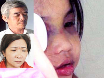 Khởi tố cặp vợ chồng bạo hành con nuôi