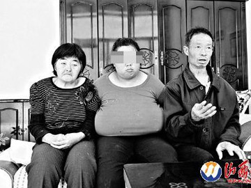 Cô gái có bộ ngực khổng lồ nặng đến 5kg