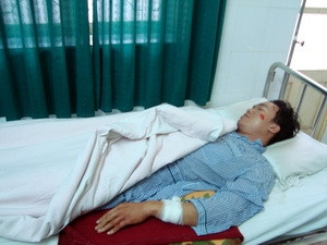 Chém công an, giải cứu đồng bọn bị truy nã