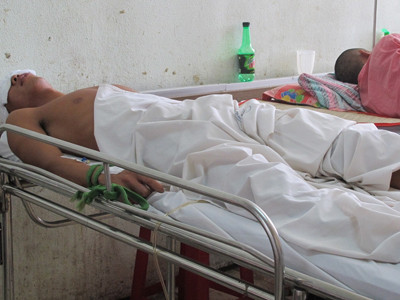 Hôn mê vì đôi đũa đâm xuyên sọ não