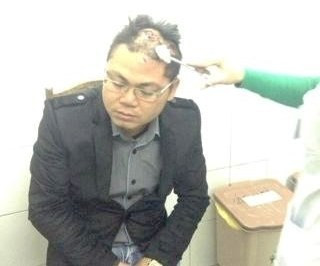 Bị chém rách đầu vì không cho nợ tiền mua nhà