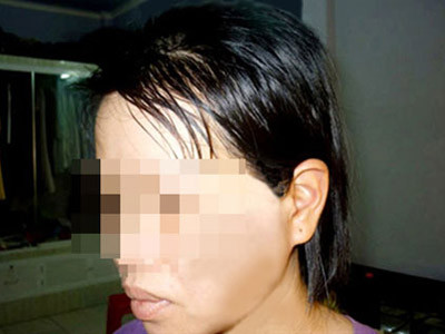 Xung quanh vụ bác sĩ bạo hành vợ ép ly hôn