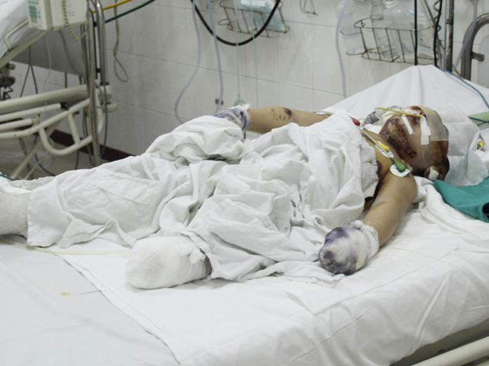 Honda hỗ trợ gia đình nạn nhân vụ nổ xe máy