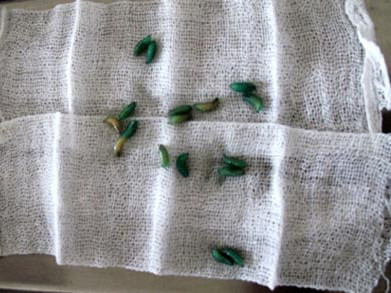 Ông già có gần trăm con dòi trong mũi