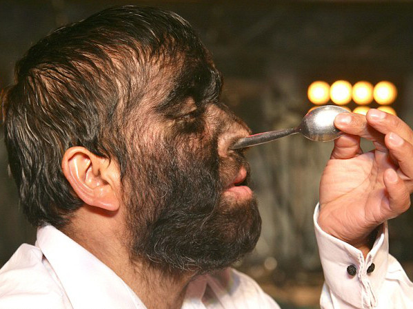 ‘Người sói’ nhét thìa vào mũi