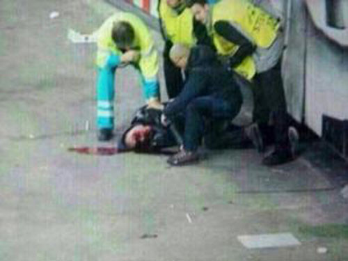 Máu chảy rất nhiều từ đầu CĐV xui xẻo