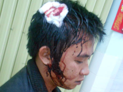 Công an, dân quân nổ súng, đánh người quên đội MBH?