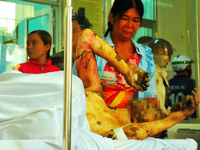 Nghi án tự thiêu vì không được chia đất