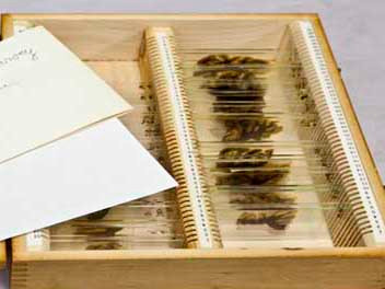 Trưng bày bộ não Einstein