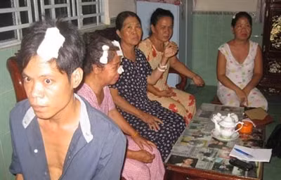 Xử lý kẻ gây ra vụ đốt, chém kinh hoàng 6 chị em
