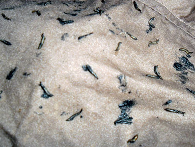 Nhiều nghi vấn 'sinh vật lạ' trong quần áo