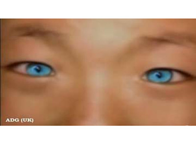 Sự thật về cậu bé mắt mèo nhìn xuyên đêm