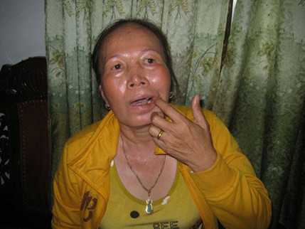 Phó ban tuyên giáo huyện ủy bị tố đánh chị dâu gãy răng