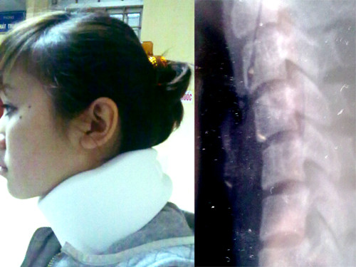 Chủ tịch CLB BĐS Hà Nội bị tố đánh con trật xương cổ