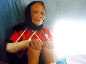 Đánh gãy hai tay mẹ vì 'dám' làm mất chim