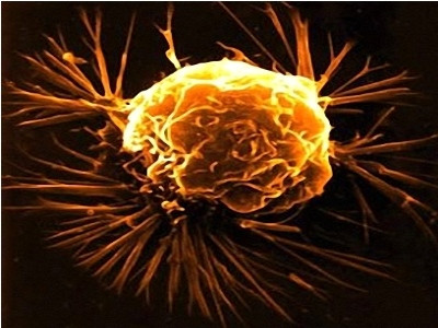 Vitamin D chống ung thư đại tràng