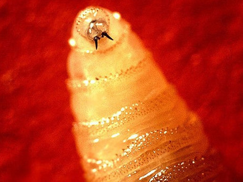 Rợn người cô gái bị ấu trùng ruồi ăn thịt đục não