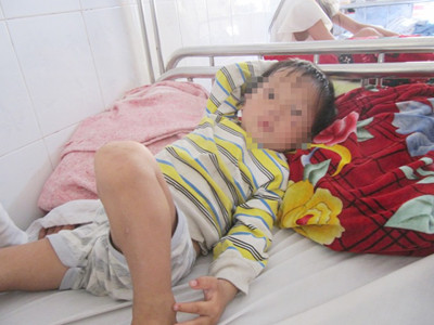 Cháu bé ba tuổi bị chó cắn gần đứt dương vật