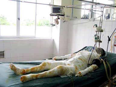 Ba người tử vong trong vụ cháu thiêu sống 11 người