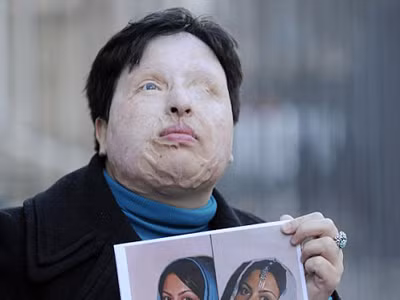 Được phép trả thù kẻ tạt axit vào mình