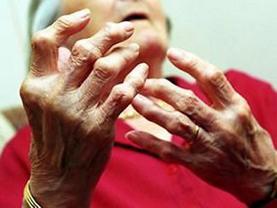 Những bệnh khớp người cao tuổi thường mắc