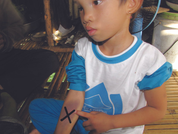 Đi từ trường về, cháu Ngân mang đầy thương tích