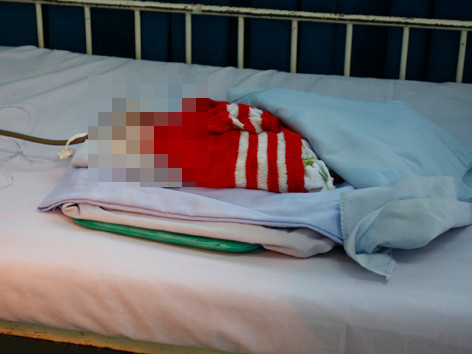 Suýt chôn sống con vì... bác sĩ