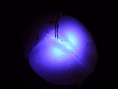 Đèn LED siêu nhỏ mới có khả năng tiêm vào não bộ
