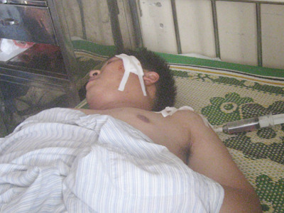 Côn đồ truy sát đối thủ, chém cảnh sát hình sự