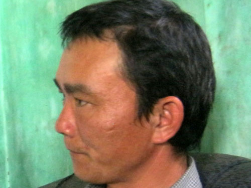 Một phụ nữ bị chồng bạo hành 10 năm