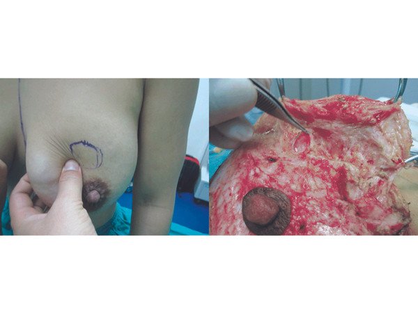 Hậu quả thảm khốc