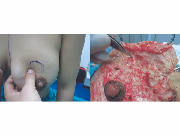 Hậu quả thảm khốc