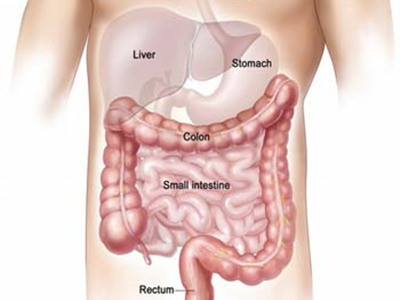 Phòng ngừa ung thư đại trực tràng