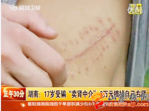 Trung Quốc buộc tội năm người trong vụ bán thận lấy iPad