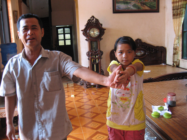 Về lại nơi trẻ bị bệnh gồ vai, 'sệ cánh'