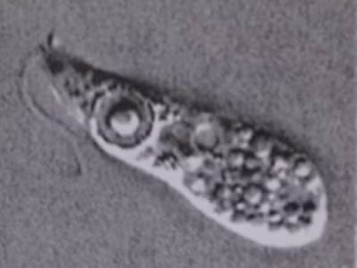 Amip ăn não người bị nghi giết chết một em bé