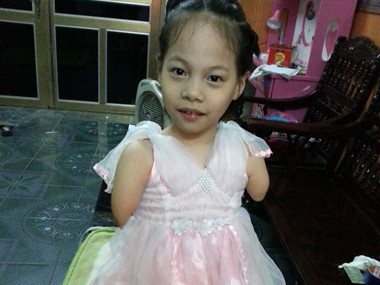 Bé gái không tay chân muốn 'ngẩng đầu với số phận'