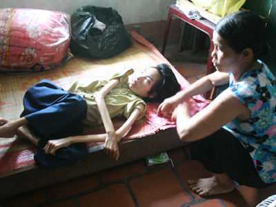 Ước mơ hiến tạng của 3 chị em