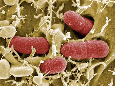Khuẩn E.coli chủng mới khiến 24 người tử vong	Ảnh: Reuters