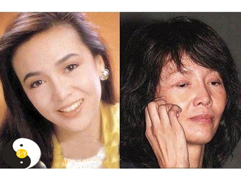 Một cô gái trở thành bà già sau ca giải phẫu thẩm mỹ