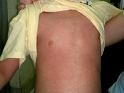 Thuốc tiêu độc cũng gây độc