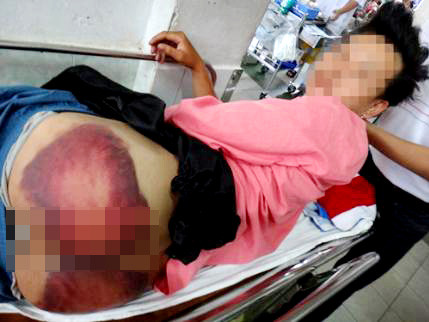 Điều tra vụ một thanh niên bị công an đánh