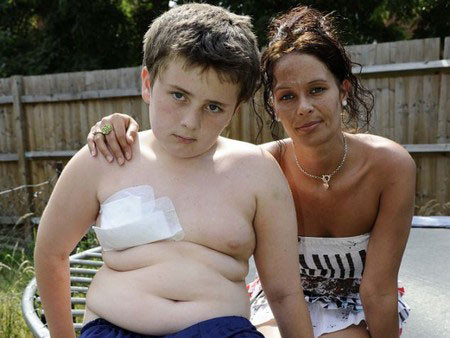 Thoát chết thần kỳ khi bị cọc sắt đâm gần tim