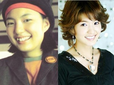 Sao Hàn ‘lột xác’ nhờ dao kéo