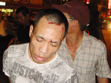 Đấm cảnh sát hình sự để thoát thân