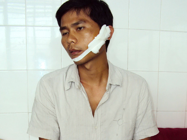 Cá độ bóng đá, chém nhau