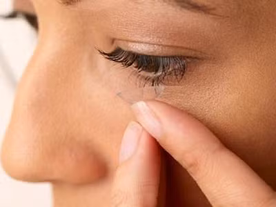 Tăng dị ứng mắt do thời tiết