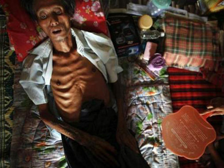 Xót xa những mảnh đời tiều tụy vì AIDS