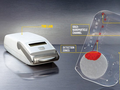 Phát hiện HIV trong vài phút với thiết bị giá 1 USD