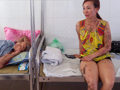 Hung thủ tạt axit 5 người khai gì tại cơ quan điều tra